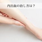 内出血の治し方は冷やす？温める？早く対処すれば早く良くなる！