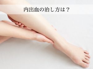内出血の治し方は冷やす？温める？早く対処すれば早く良くなる！