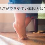 うちの子、あざができやすい？軽くぶつけただけであざになる原因とは？