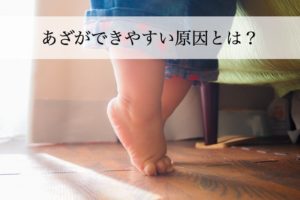 うちの子、あざができやすい？軽くぶつけただけであざになる原因とは？