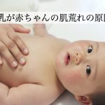 赤ちゃんの肌荒れはママの母乳が原因？母乳を改善するための工夫とは？