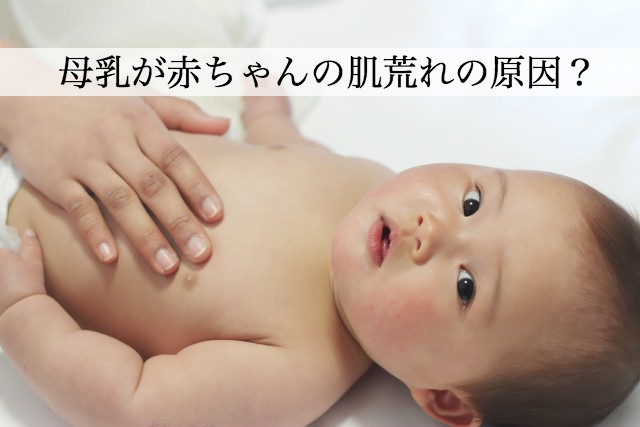 赤ちゃんの肌荒れはママの母乳が原因？母乳を改善するための工夫とは？
